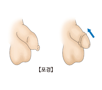 포경