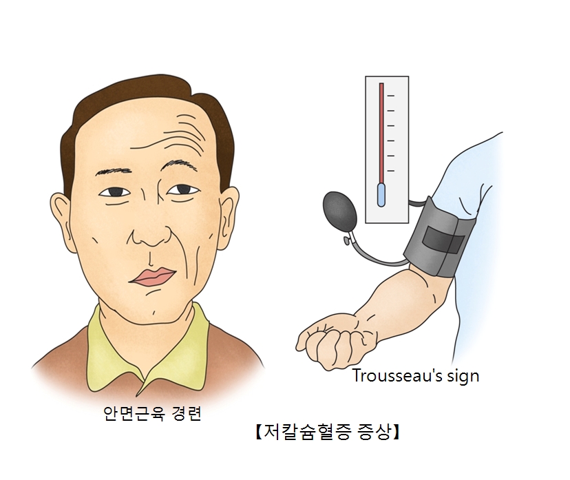 저칼슘혈증