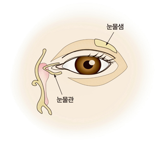 비루관 폐쇄