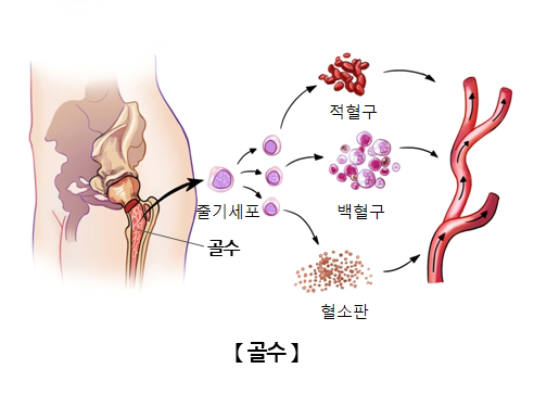 골수