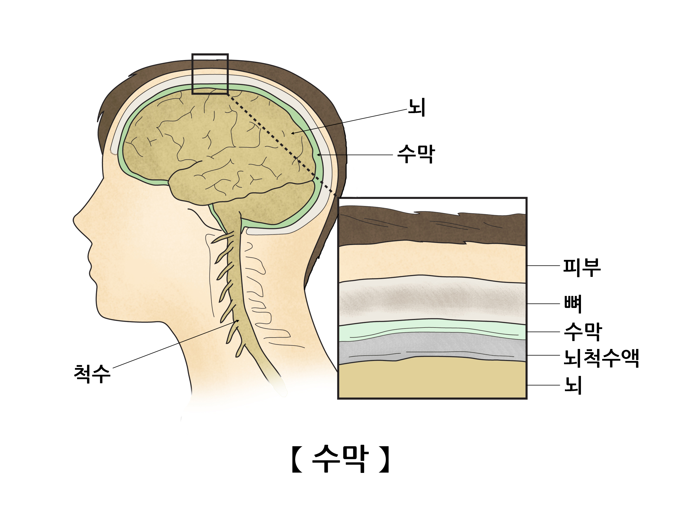 수막