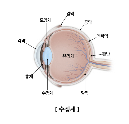 수정체